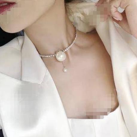 尹肖霞的去頸紋術(shù)后照