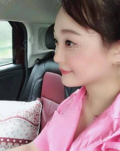 成思坤的去頸紋術(shù)前照片