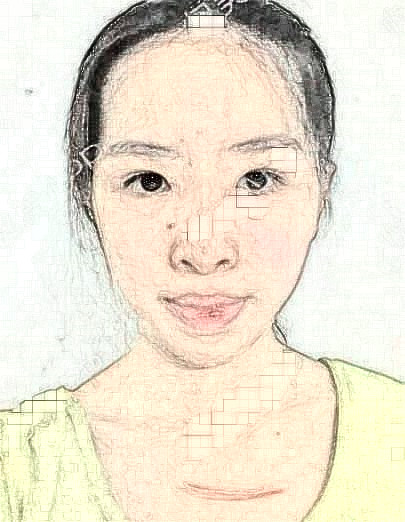 申茗之的祛疤術(shù)前照片