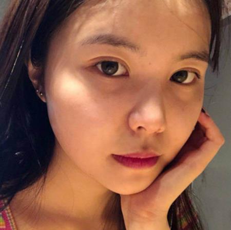 魯膺衛(wèi)的面部拉皮術前照片