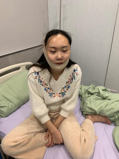 龍?zhí)羟榈睦こ櫺g(shù)前照片