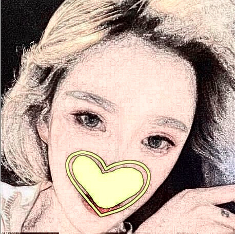 安徽維多利亞整形外科醫(yī)院盛宗順醫(yī)生做磨骨瘦臉怎么樣？附磨骨瘦臉案例效果對比圖