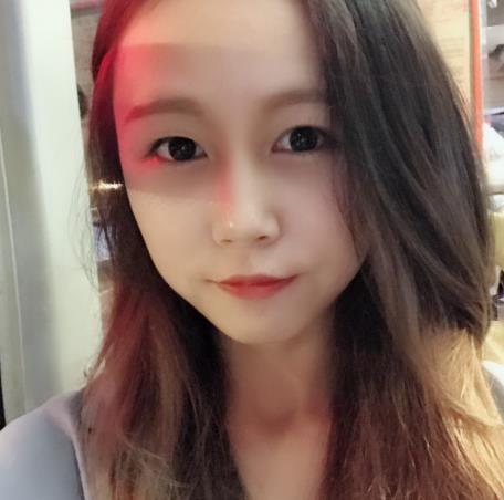 蕭景濠的瘦臉針術(shù)前照片