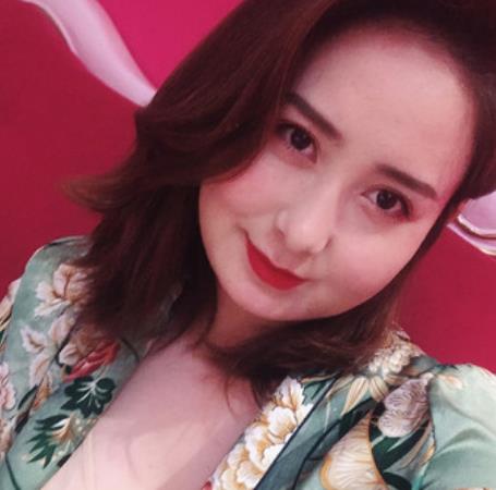 鈕耀毅的面部吸脂術(shù)前照片