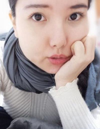 彭瀚鵬的面部吸脂術(shù)前照片