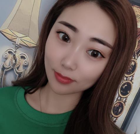 邊垚垚的雙眼皮術(shù)后照片