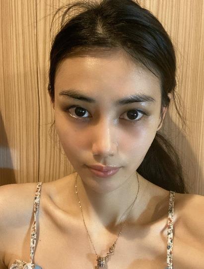 姜凱鏵的雙眼皮術(shù)前照片