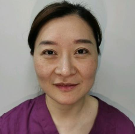 賀學婭的面部拉皮術前照片