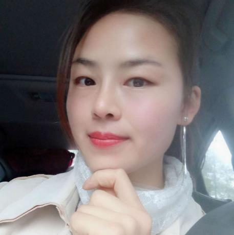 嚴奕文的隆鼻術(shù)后照片