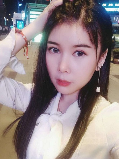 金通運的下頜角磨骨術(shù)后照片