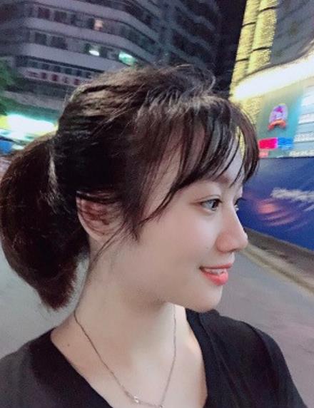 許馨蓉的激光去眼袋術(shù)前照片