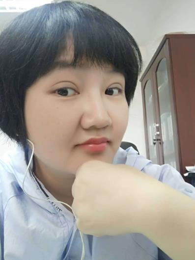 應(yīng)弈樂的全切雙眼皮術(shù)后照片