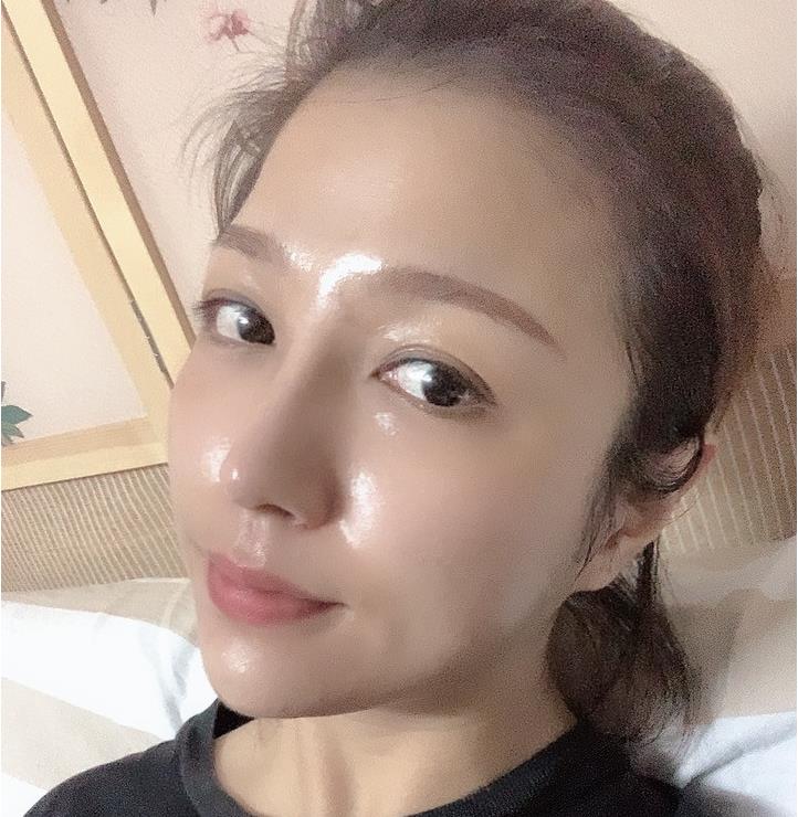 安慶維多利亞醫(yī)療美容門診部彭鵬醫(yī)生做鼻修復(fù)怎么樣？附鼻修復(fù)案例效果對比圖