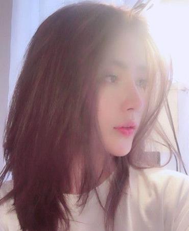 安慶施漢彬愛爾眼科醫(yī)院施漢彬醫(yī)生做鼻修復(fù)怎么樣？附鼻修復(fù)案例效果對比圖