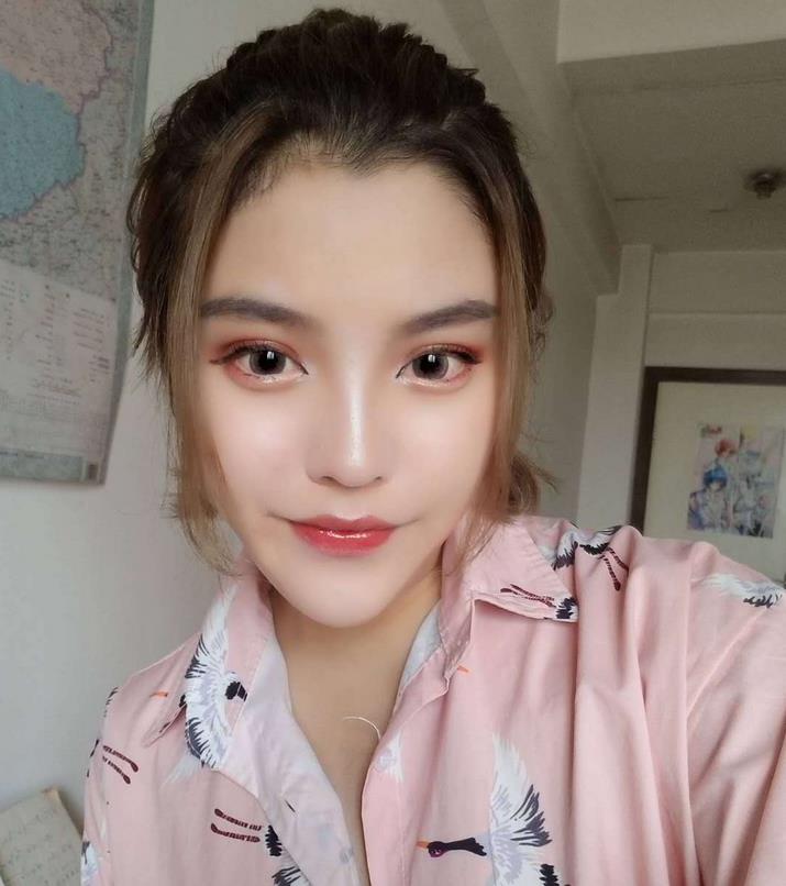 安陽修形美林整形醫(yī)院秦瑞奇醫(yī)生做隆鼻怎么樣？附隆鼻案例效果對比圖