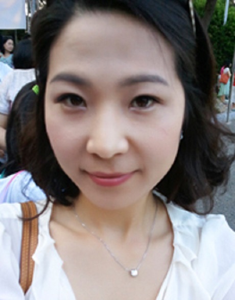 尹德潤的去眼角紋術前照片