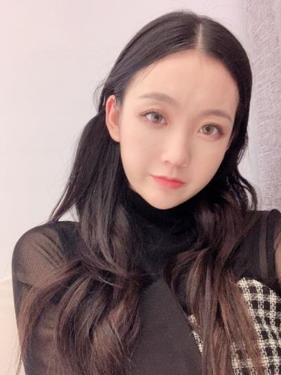 公驛平的拉皮術(shù)后照