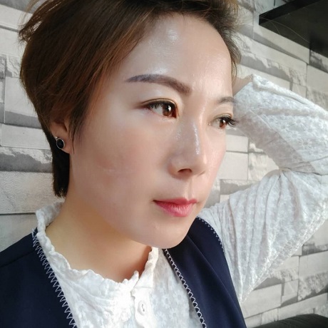 安陽姣點(diǎn)醫(yī)療美容門診部曹鵬飛醫(yī)生做去眼角紋怎么樣？附去眼角紋案例效果對比圖