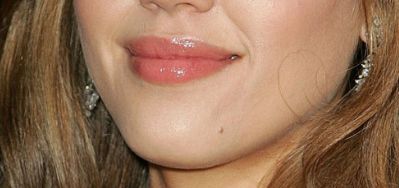 廣州韓妃李光琴雙眼皮手術(shù)效果分享，醫(yī)生真實(shí)案例全揭秘！