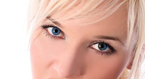 成都游曉波醫(yī)生分享下頜角整形成果