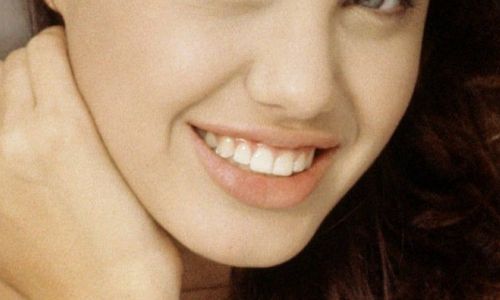 上海美聯(lián)臣安薇吸脂減肥費(fèi)用和技術(shù)優(yōu)勢揭秘！