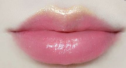 長沙藝星副教授秦曉東為您帶來鼻修復案例分享