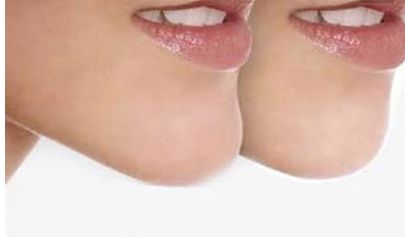 廈門薇格整形：領(lǐng)先的隆鼻技術(shù)與醫(yī)生案例分享