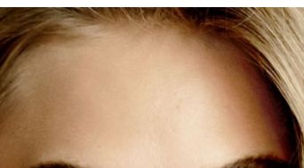 北京米揚麗格整形醫(yī)院的隆鼻技術(shù)解析，絕佳案例揭秘！