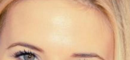 尹寧北隆鼻手術費用價格是多少？顯貴還是親民？手術全過程詳解！