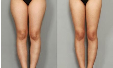 饒尚美醫(yī)美門診部主任劉芳艷，專注面部美容方案定制