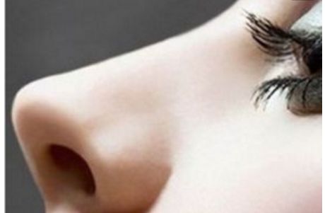 許滿萍醫(yī)生的醫(yī)療技術實力及激光祛斑案例分享