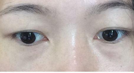 深圳整形行業(yè)最受推崇的隆鼻醫(yī)生名單發(fā)布！李天石、于麗等備受贊譽(yù)的專家！