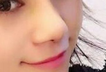 成都市第三人民醫(yī)院鼻部整形醫(yī)術集錦：葉飛輪醫(yī)生備受矚目，驚艷案例首度曝光