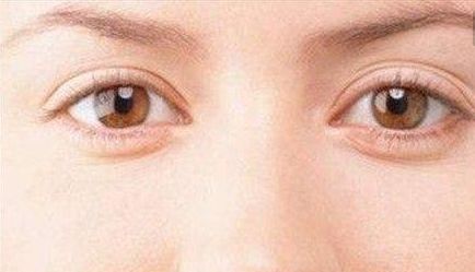 醫(yī)生雷振東的鼻部整形技術(shù)成都大華效果如何？真實(shí)案例分享