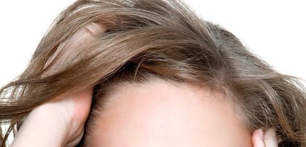 李開征豐面頰案例圖及其效果分享