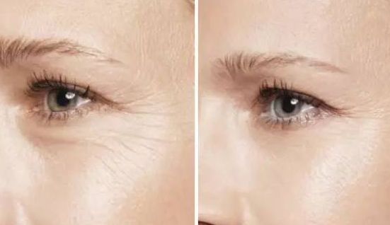 南寧2023年最受推崇的雙眼皮醫(yī)生名單揭曉，知名專家麥慧、廖明德、龍海波等紛紛上榜