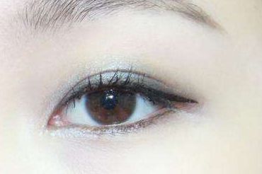 協(xié)和鐘愛梅隆鼻案例，專業(yè)改造滿意度高