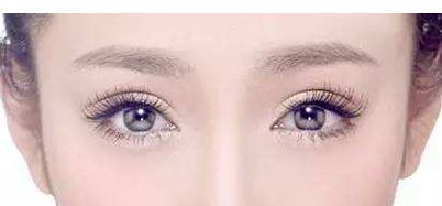 上海余東雙眼皮修復(fù)，效果怎么樣？余東與徐小菲相比，哪個更受歡迎？