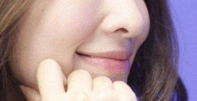 上海九院楊嫻嫻雙眼皮效果及醫(yī)生介紹—展現(xiàn)雙眼神采與美貌