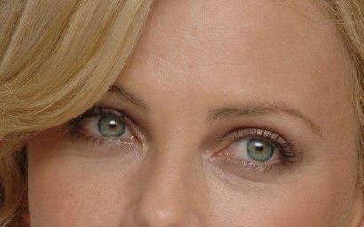 沈陽陸軍總院去除眼袋效果如何？醫(yī)生技術(shù)值得信賴！從案例看去眼袋效果