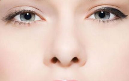 云南銅雀臺(tái)趙蘭明醫(yī)生鼻部手術(shù)效果如何？獨(dú)家案例分享揭秘