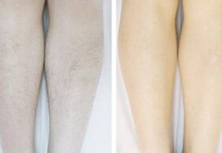 山城整形科，鼻部整形效果被大量親測案例證實