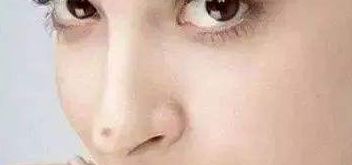 貴州省人民醫(yī)院整形科最近推出的驚艷隆鼻案例現(xiàn)身！