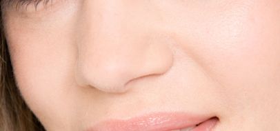 北京八大處整形醫(yī)院宋濤博士：憑借優(yōu)秀的技術(shù)和成功的隆鼻案例，在整形行業(yè)大放異彩！