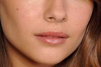 北京李傳康醫(yī)生雙眼皮術的出色效果，2023年令人驚嘆的案例發(fā)布