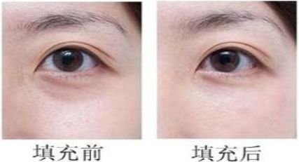 長沙協(xié)雅明經(jīng)發(fā)醫(yī)生神奇瘦身術揭秘