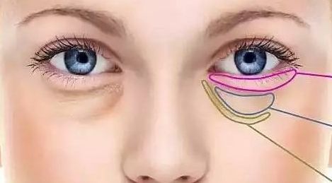 醫(yī)生分享：福州的比華利整形效果如何？祛斑案例揭秘！