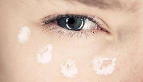 同濟醫(yī)院任玉萍醫(yī)生值得信賴？探秘武漢受歡迎整形專家提供的案例與資料