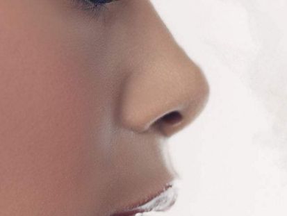 煙臺曹品根醫(yī)生90天雙眼皮修復案例一覽，效果驚艷！