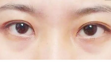 成都德云整形醫(yī)院專業(yè)整形醫(yī)生來介紹，整形手術(shù)費用詳細報價，真實隆胸手術(shù)成功案例大揭秘